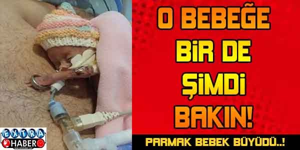 PARMAK BEBEK BÜYÜDÜ O BEBEĞE BİR DE ŞİMDİ BAKIN...
