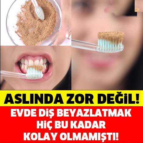 Aslında evde diş beyazlatmak bu kadar kolay! İşte en kolay ve en etkili yöntem...