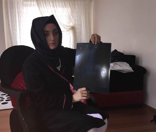 Doktor İnanamadı Psikolojik Dedi Ama... Karnından Çıkanı Görünce Bayıldı!