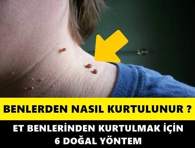 Et Benlerinden Kurtulmak İçin 6 Doğal Yöntem!!