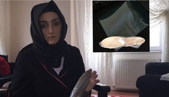 Doktor İnanamadı Psikolojik Dedi Ama... Karnından Çıkanı Görünce Bayıldı!