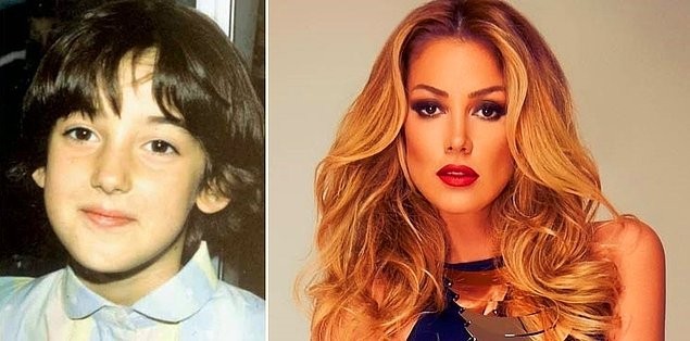KİM DERDİ BU ÇİRKİN KIZ BÜYÜYÜNCE TÜRKİYE'NİN EN GÜZEL KADINI OLACAK!