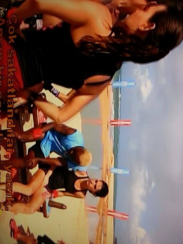 SURVİVOR'DA SAKATLIK ŞOKU! DOKTOR OYUNA DEVAM ETTİRMEDİ! BAKIN DURUMU NASIL!