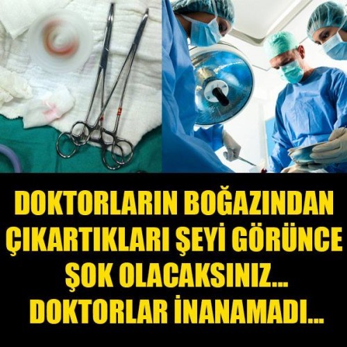 UYURKEN BOĞAZINA KAÇTI DOKTORLAR ŞOK OLDU...