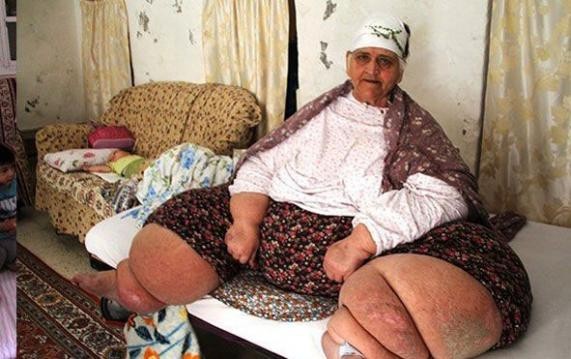 Bu hastalıklara inanamayacaksınız!