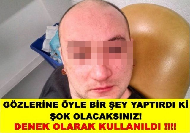 GÖZLERİNE ÖYLE BİR ŞEY YAPTIRDI Kİ ŞOK OLACAKSINIZ!