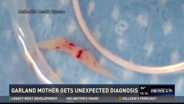 Beyninden Çıkan Şey Doktorları Şoke Etti!