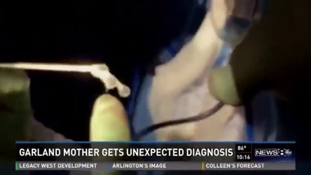 DOKTORLAR DEHŞETE DÜŞTÜ! BEYNİNDEN BAKIN NE ÇIKTI!