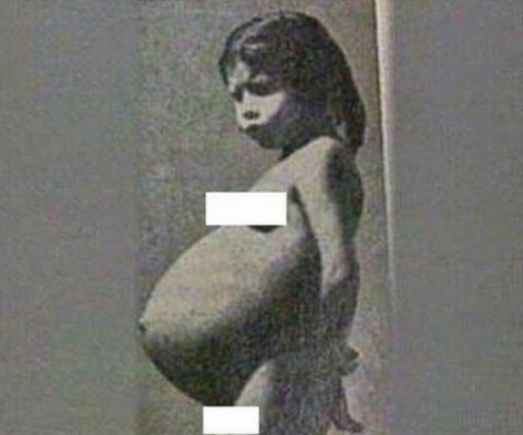 5 YAŞINDA HAMİLE KALIP ANNE OLMUŞTU! İŞTE SON HALİ...