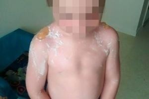 DİKKAT SİZİNDE BAŞINIZA GELEBİLİR!! BU ÇOCUĞA NE OLDU BÖYLE GÖRENLER DÖNÜP BİR DAHA BAKIYOR!