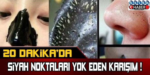 20 dakikada siyah noktaları yok eden karışım !