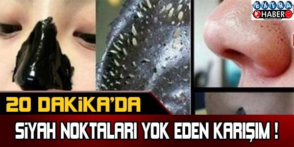 20 dakikada siyah noktaları yok eden karışım !