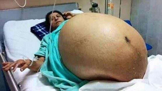 Herkesi kandırmışlar! Meğer karnındaki bebek değilmiş...
