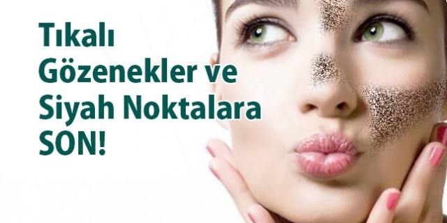 20 dakikada siyah noktaları yok eden karışım !