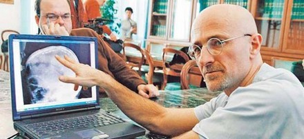 KAFASINI BAŞKA BİR BEDENE TAKACAKLAR..!