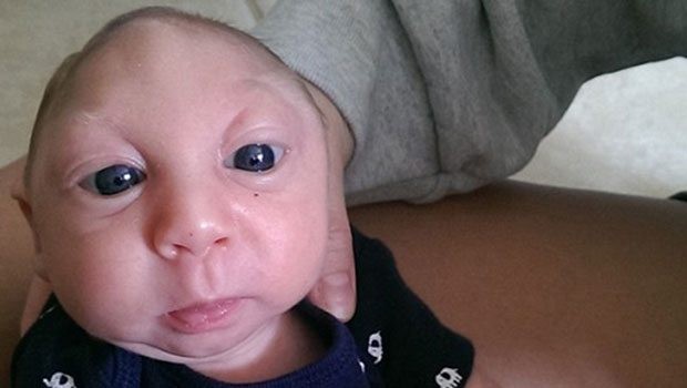 DÜNYACA ÜNLÜ 'MUCİZE BEBEK' 1 YAŞINDA!
