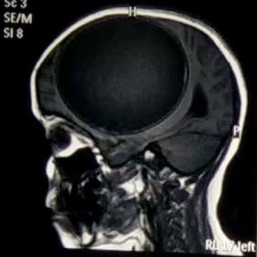 BİR TARAFI FELÇLİ OLAN KIZI MUAYENE EDEN DOKTOR SEBEBİNİ ANLAYINCA ŞOKE OLDULAR...