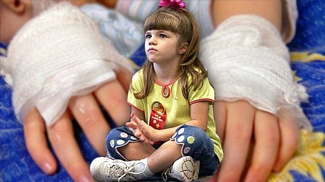 Kafanızın Çekiçle Ezildiğini Ama Hiç Acı Hissetmediğinizi Düşünün!  Tüm Detaylarıyla CIPA hastalığı