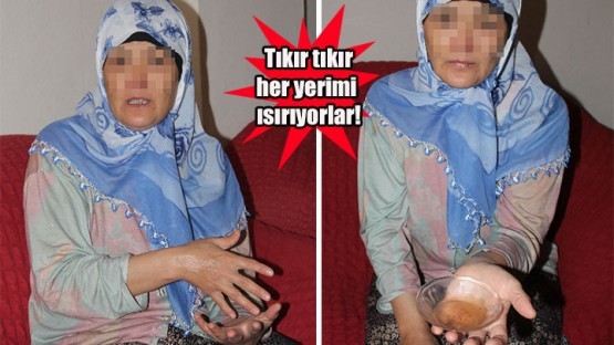 BU KADININ VÜCUDUNDAN ÖYLE BİR HAYVAN ÇIKIYOR Kİ... ŞOK OLACAKSINIZ..!