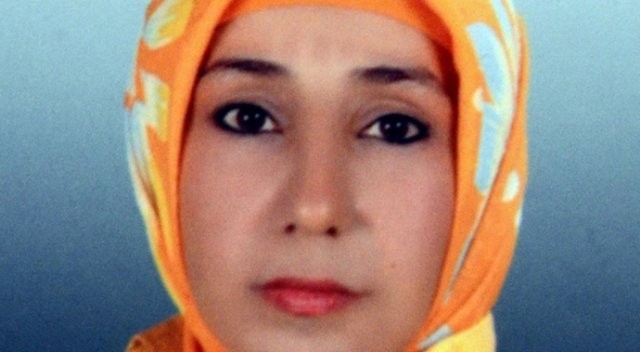 Genç Kadın Yangında Yüzünü Kaybetti! Son Haline İnanamayacaksınız..