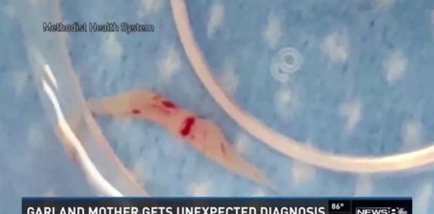 BAŞ AĞRISI DİYE GİTTİ FİLMİNDEN ÇIKAN SONUÇ DOKTORU BAYILTTI..!