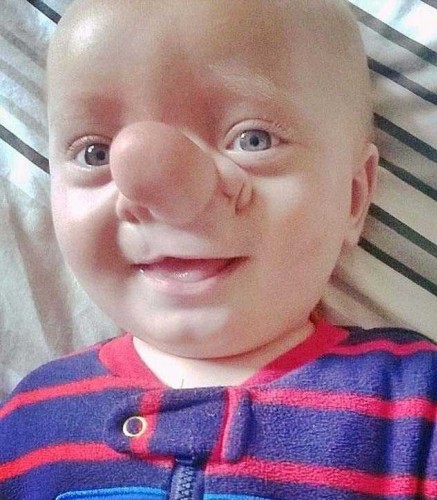PİNOKYO BURUNLU ÇOCUK... DÜNYA BU ÇOCUĞU KONUŞUYOR!