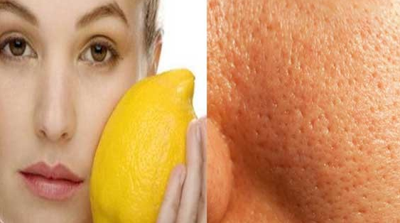 20 DAKİKADA SİYAH NOKTALARI YOK EDEN KARIŞIM!