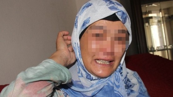 BU KADININ VÜCUDUNDAN ÖYLE BİR HAYVAN ÇIKIYOR Kİ... ŞOK OLACAKSINIZ..!