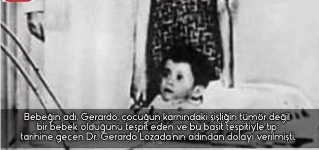 5 YAŞINDA NASIL ANNE OLDU? KÜÇÜK ANNENİN HİKAYESİ HERKESİ ŞAŞKINA ÇEVİRDİ!