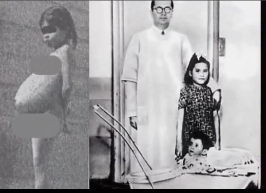 5 YAŞINDA NASIL ANNE OLDU? KÜÇÜK ANNENİN HİKAYESİ HERKESİ ŞAŞKINA ÇEVİRDİ!