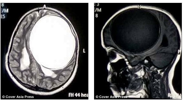 BİR TARAFI FELÇLİ OLAN KIZI MUAYENE EDEN DOKTOR SEBEBİNİ ANLAYINCA ŞOKE OLDULAR...