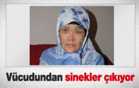 BU KADININ VÜCUDUNDAN ÖYLE BİR HAYVAN ÇIKIYOR Kİ... ŞOK OLACAKSINIZ..!