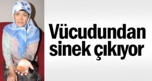 BU KADININ VÜCUDUNDAN ÖYLE BİR HAYVAN ÇIKIYOR Kİ... ŞOK OLACAKSINIZ..!