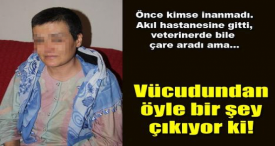 BU KADININ VÜCUDUNDAN ÖYLE BİR HAYVAN ÇIKIYOR Kİ... ŞOK OLACAKSINIZ..!