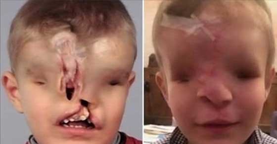 AĞZI BURNU VE GÖZLERİ YOKTU! SON HALİNE ÇOK ŞAŞIRACAKSINIZ!