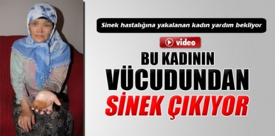 BU KADININ VÜCUDUNDAN ÖYLE BİR HAYVAN ÇIKIYOR Kİ... ŞOK OLACAKSINIZ..!