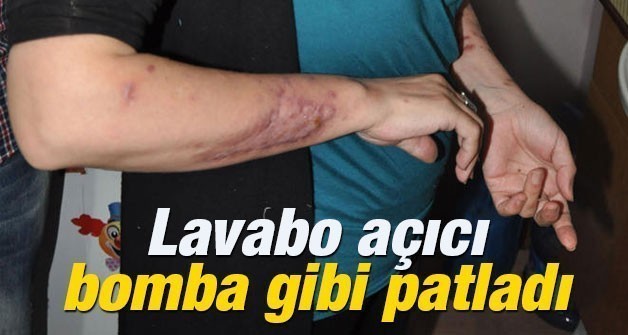 BAYANLAR DİKKAT! LAVABOYA DÖKTÜ BOMBA GİBİ PATLADI!