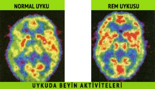 Tüm İnsanlığın Ortak Sorunu! KARABASAN