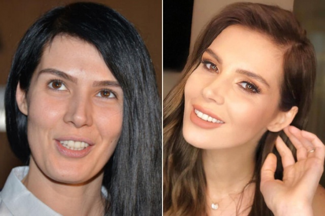 Makyaj Yapmamak Moda Oldu
