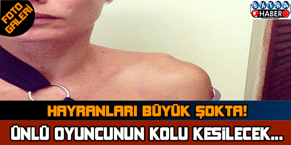 ÜNLÜ OYUNCUNUN KOLU KESİLİYOR..!
