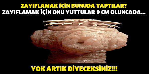 Zayıflamak için onu yutuyorlar 9 cm olunca da...