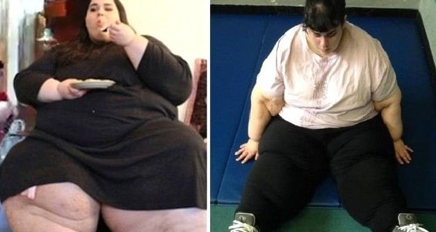 Ölmesi Beklenirken Tam 127 Kilo Verdi! Şimdi Görenler..
