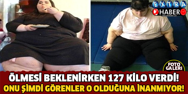 Ölmesi Beklenirken Tam 127 Kilo Verdi! Şimdi Görenler..