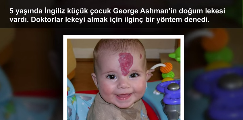 Dünya'da 5 Gereksiz Ameliyat!