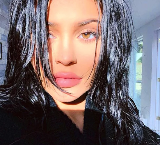 Eski Haline mi Dönüyor? Kylie Jenner Dudak Dolgusunu Çıkarttırdı, Yeni Görüntüsüyle Herkesi Şok Etti!