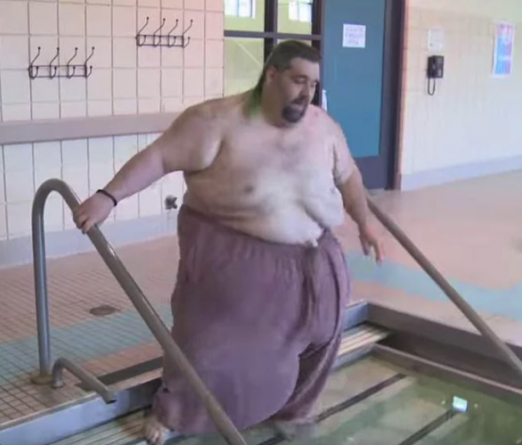 Devasa Lenf Ödemi Nedeniyle Testisleri 31 Kiloya Ulaştığı İçin 9 Yıl Boyunca Seks Yapamayan Adam
