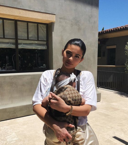 Eski Haline mi Dönüyor? Kylie Jenner Dudak Dolgusunu Çıkarttırdı, Yeni Görüntüsüyle Herkesi Şok Etti!