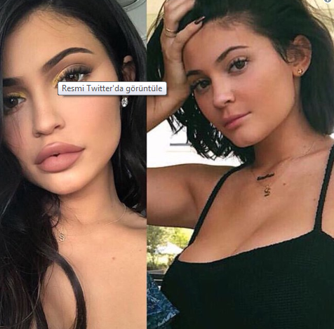 Eski Haline mi Dönüyor? Kylie Jenner Dudak Dolgusunu Çıkarttırdı, Yeni Görüntüsüyle Herkesi Şok Etti!