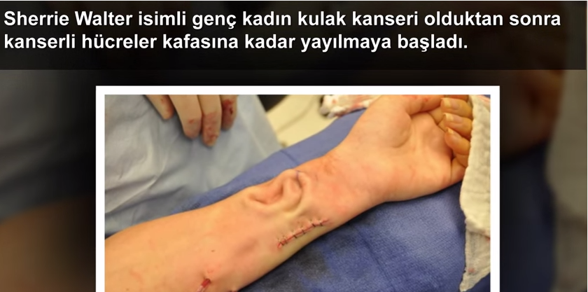 Dünya'da 5 Gereksiz Ameliyat!