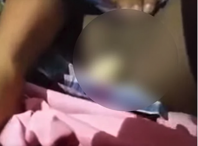 Son İki Yıldır Düzenli Olarak Yumurtladığını İddia Eden Endonezyalı Çocuk Doktorları Şok Etti!